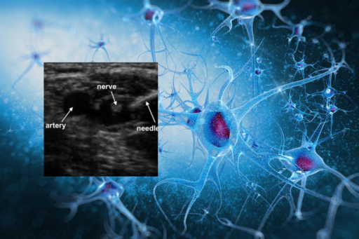 Diagnostyka ultrasonograficzna nerwów obwodowych (24 – 25 kwietnia 2026r.)