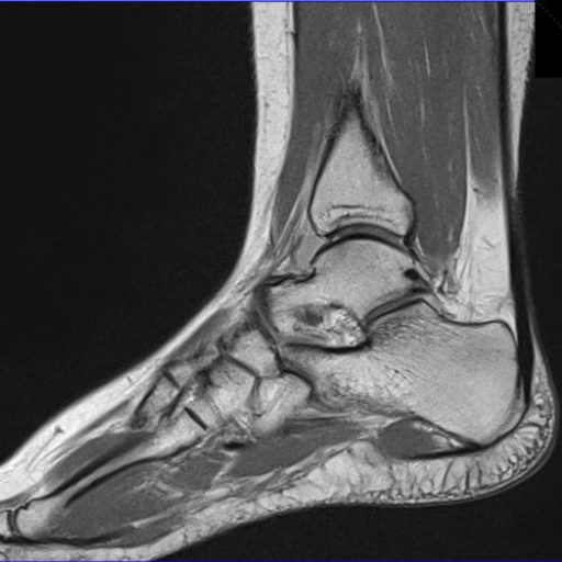 Stopa, staw skokowy, ścięgno Achillesa – kompleksowa diagnostyka obrazowa (RTG, USG, TK, MR)