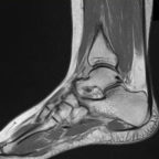 Stopa, staw skokowy, ścięgno Achillesa – kompleksowa diagnostyka obrazowa (30 września – 2 października 2026r.)