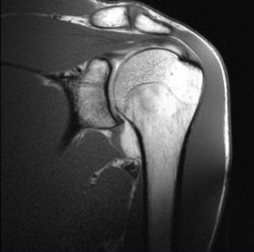 Staw ramienny – kompleksowa diagnostyka obrazowa (10-12 marca 2027r.)