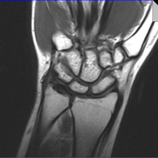Staw łokciowy i ręka – kompleksowa diagnostyka obrazowa (RTG, USG, TK, MR)
